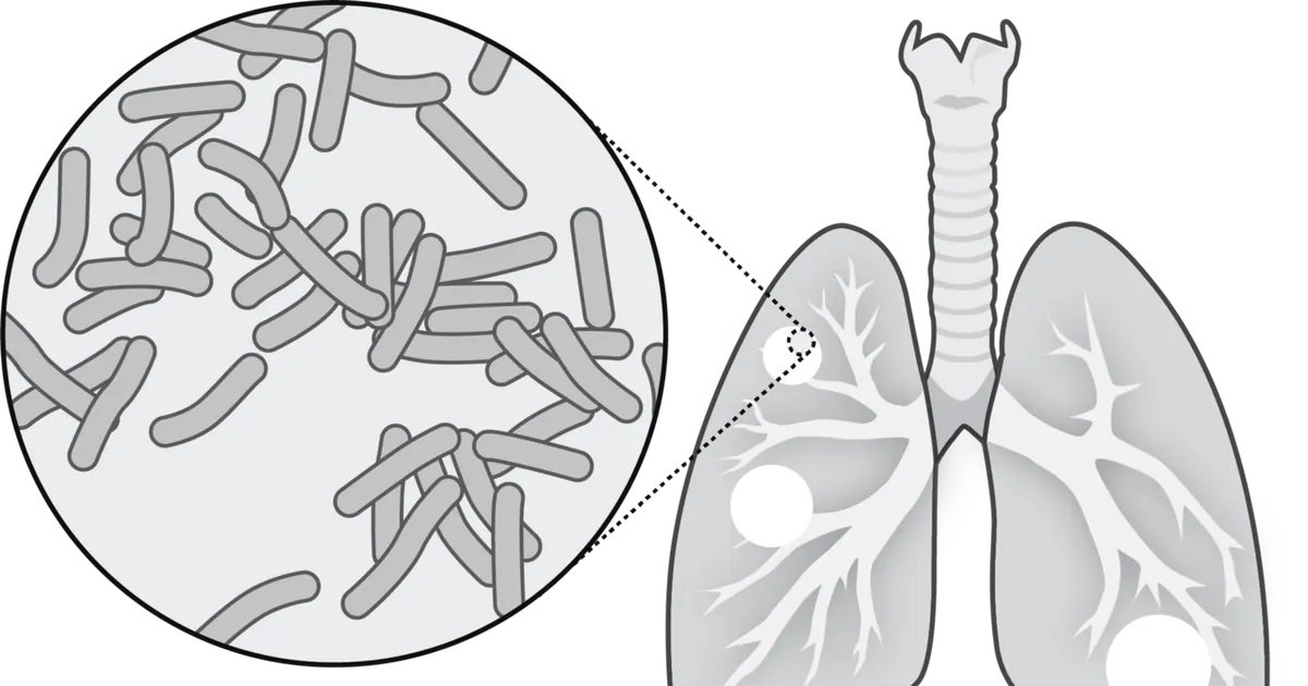 Scientific illustration of rod-shaped tuberculosis bacteria next to a drawing of human lungs